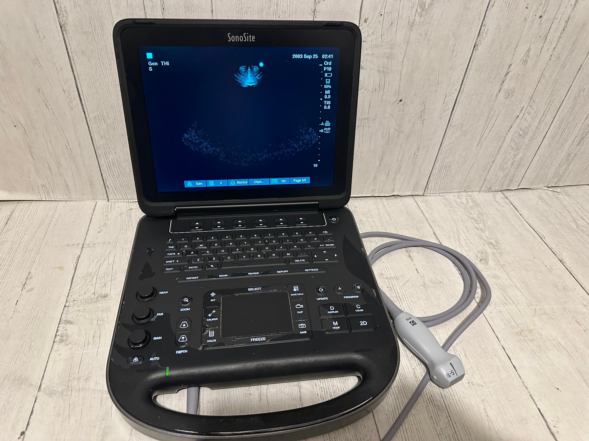 Sonosite Edge II Ultrasound 2016, DICOM  with Phased  Array probe rP19x DIAGNOSTIC ULTRASOUND MACHINES FOR SALE