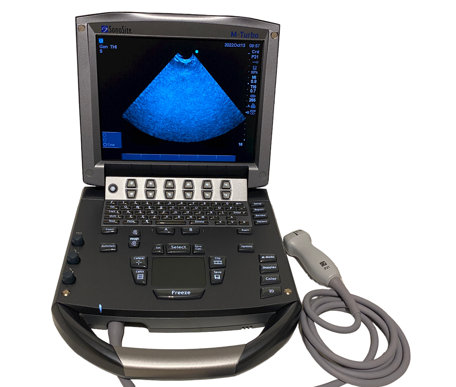 Sonosite M-Turbo Portable Ultrasound 2018 with Cardiac probe P21xi DIAGNOSTIC ULTRASOUND MACHINES FOR SALE