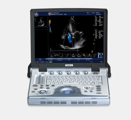 GE Vivid E Ultrasound System