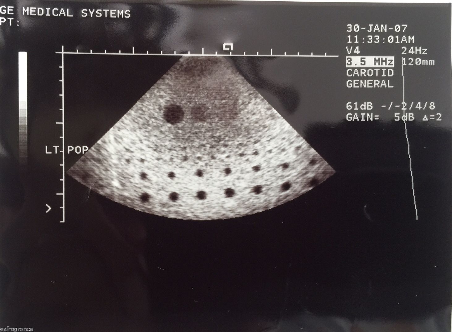 Acuson 4 Needle Guide V4 Ultrasound Transducer Probe / Tested DIAGNOSTIC ULTRASOUND MACHINES FOR SALE