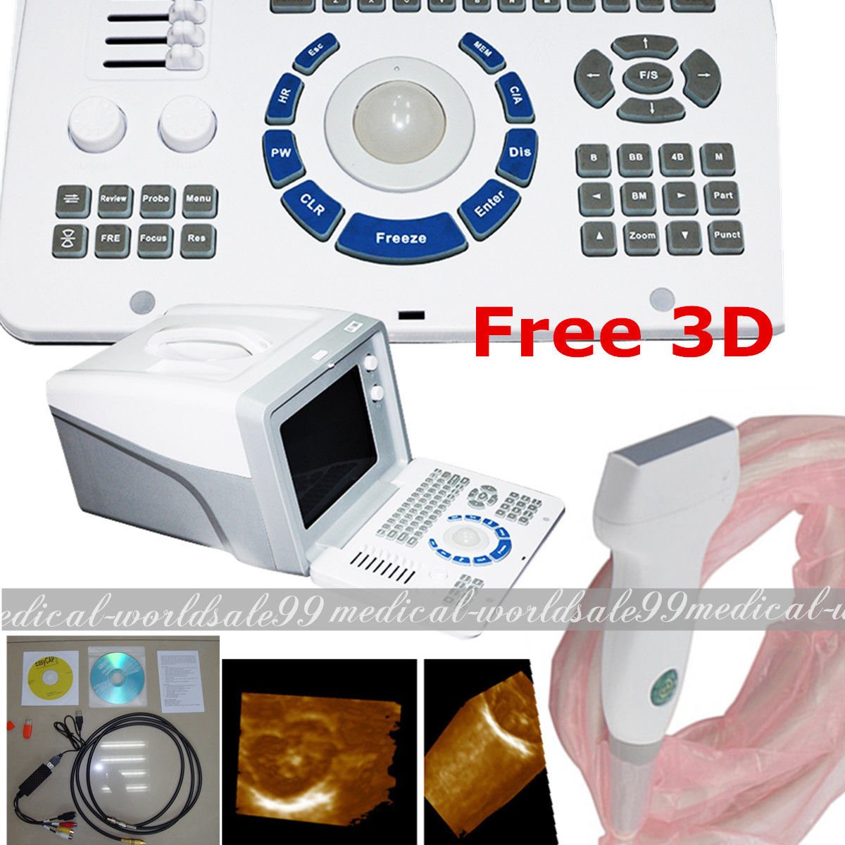 Digital Portable Ultrasound Scanner Diagnostic Machine 7.5Mhz Linear Probe 3D CE 190891499295 DIAGNOSTIC ULTRASOUND MACHINES FOR SALE