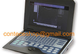 Portable Laptop Machine Digital Ultrasound Scanner, probe, human/vet, USA Fedex