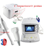 Digital Portable Ultrasound Scanner +convex+linear+Vaginal 3 Probes/Sensors 3D 190891896759