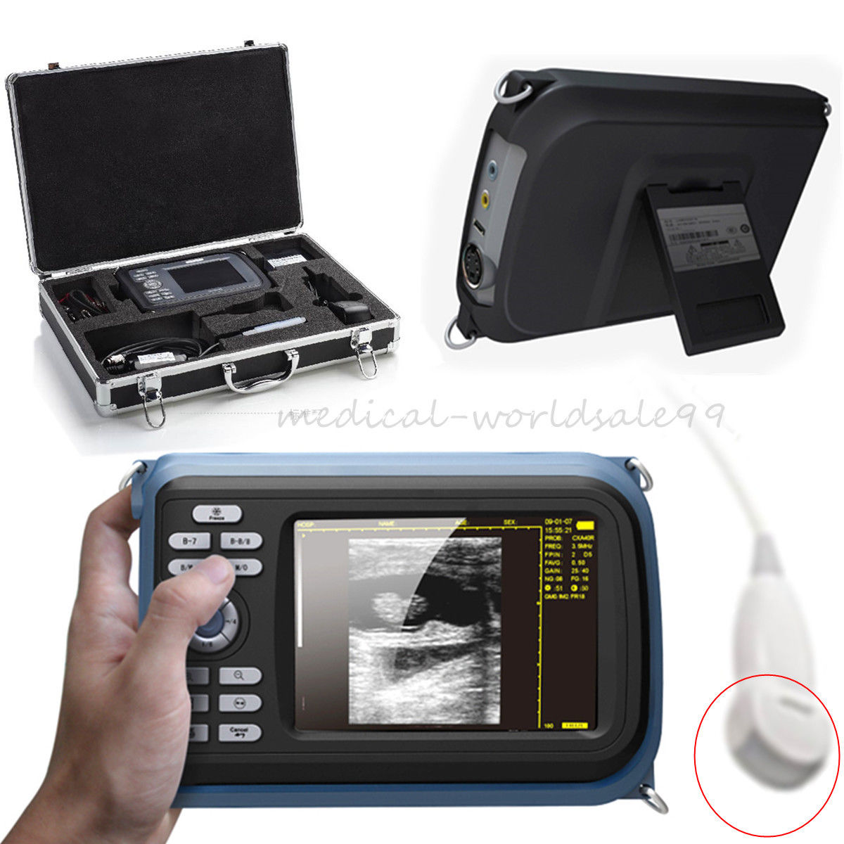 Digital Handheld Ultrasound Scanner Ultrasound Machine  Micro-Convex Probe A+ DIAGNOSTIC ULTRASOUND MACHINES FOR SALE