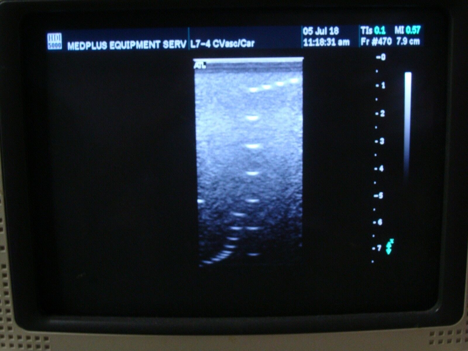 L7-4 LINEAR ARRAY TRANSDUCER PROBE FOR ATL HDI 5000 SONOCT ULTRASOUND SYSTEM DIAGNOSTIC ULTRASOUND MACHINES FOR SALE