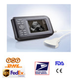 5.5Inch TFT Handheld Ultrasound Scanner/Machine  +Convex Probe + Case Human Use