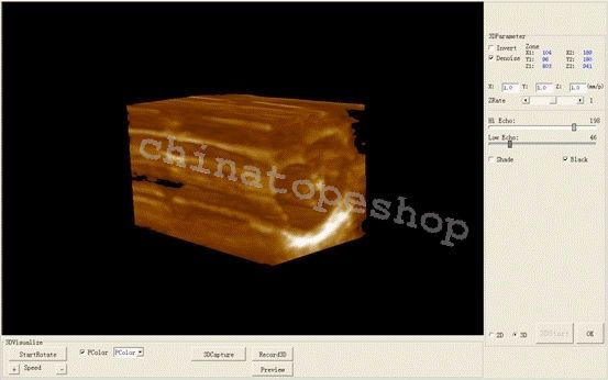 Digital Laptop Notebook ultrasound scanner machine Convex  Linear 2 probes 3D 190891559289 DIAGNOSTIC ULTRASOUND MACHINES FOR SALE