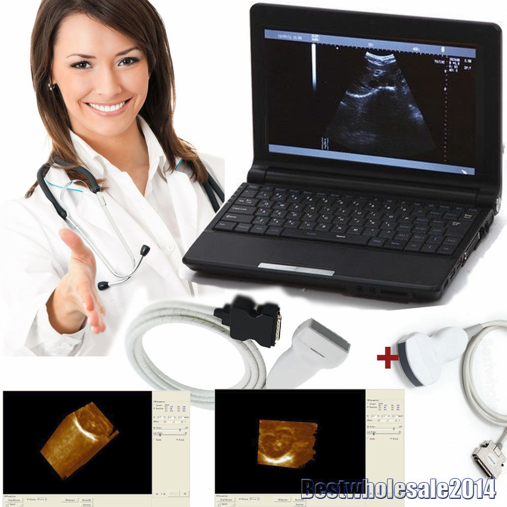 Digital Laptop Ultrasound Scanner  Convex + Linear Probe 3D Ultrasound Pregnant DIAGNOSTIC ULTRASOUND MACHINES FOR SALE