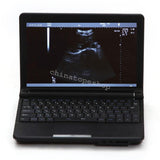 igital Laptop Notebook ultrasound scanner machine +Micro Convex probes Sale