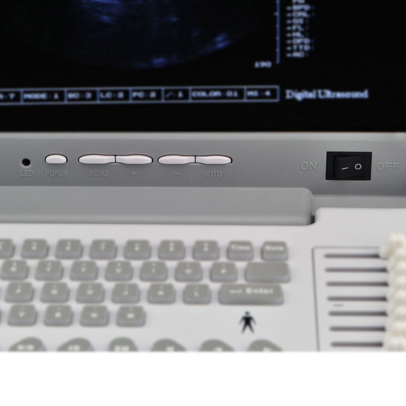 New SALE 39% Ultrasound Scanner Digital Machine + Convex &Linear 2 Probes + 3D 190891249302 DIAGNOSTIC ULTRASOUND MACHINES FOR SALE