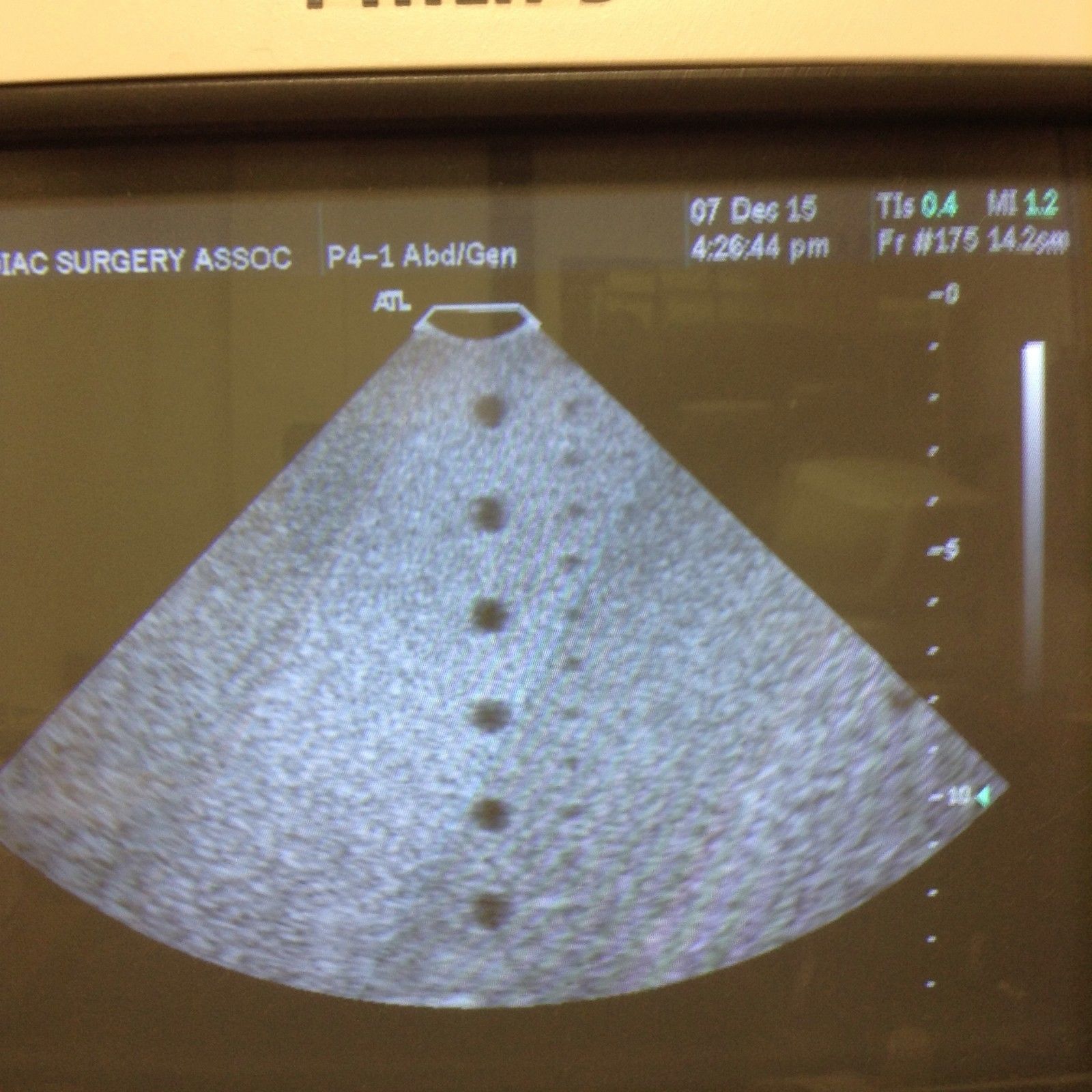 ATL P4-1 cardiac ultrasound probe DIAGNOSTIC ULTRASOUND MACHINES FOR SALE