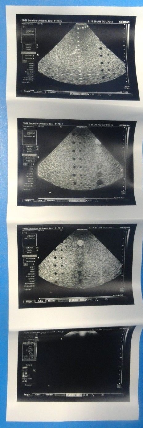 2008 Siemens Acuson Antares PH4-1 Frequency 4–1 MHz Ultrasound  Probe (6831) DIAGNOSTIC ULTRASOUND MACHINES FOR SALE