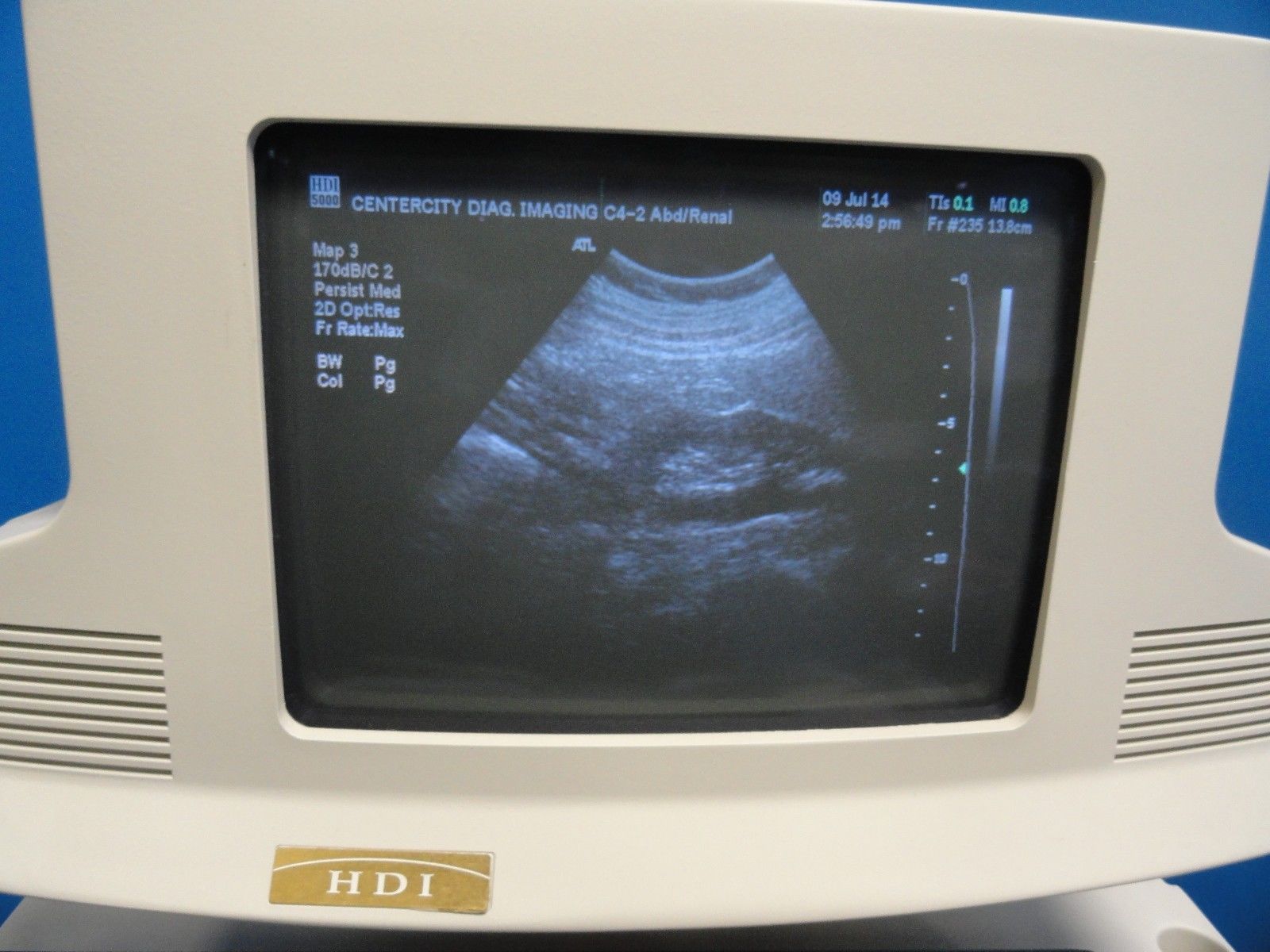 ATL AT3C42B / C4-2 Curved Array Broadband Probe (Abdominal OB/GYN General )6853 DIAGNOSTIC ULTRASOUND MACHINES FOR SALE