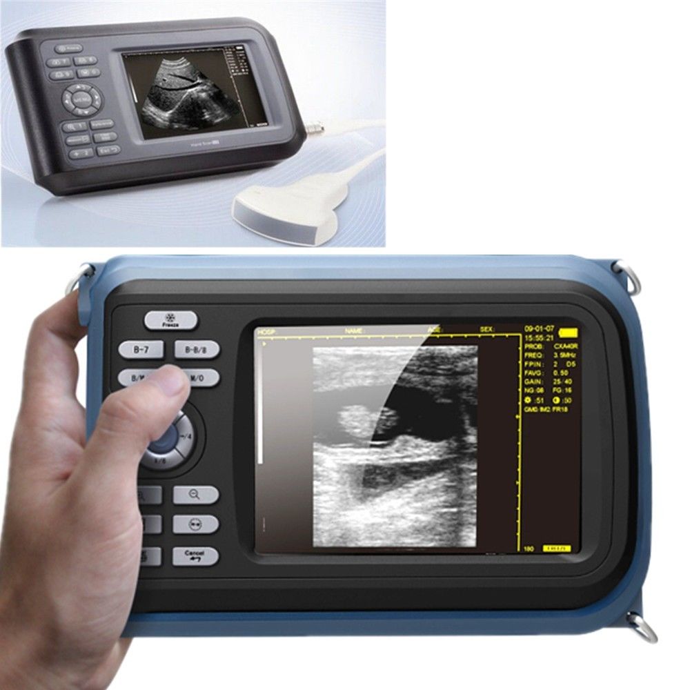 Handheld Ultrasound Scanner Machine Convex Probe+Pulse Oximeter + Battery + Case DIAGNOSTIC ULTRASOUND MACHINES FOR SALE