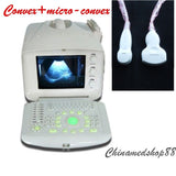 Digital Ultrasound Scanner Machine+Convex & Micro-convex  Probe/Transducer 3D AA 190891536136