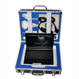 Laptop Ultrasound Scanner Machine Convex+Linear Probe 3D Scanning Sale 190891509420
