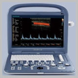Used SonoScape S2 with Linear Array Probe L741 Excellent Condition,MSK,Vascular