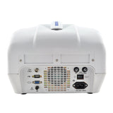Protable Ultrasound Scanner Micro-Convex Probe Ultrasonic Machine 3 d ultrasound