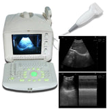 Digital Portable Machine Ultrasound Scanner 7.5Mhz Linear probe USB port 3D Sale
