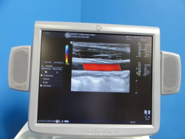 GE  7L Linear Array Ultrasound Transducer for Logiq & Vivid Series (10760) DIAGNOSTIC ULTRASOUND MACHINES FOR SALE