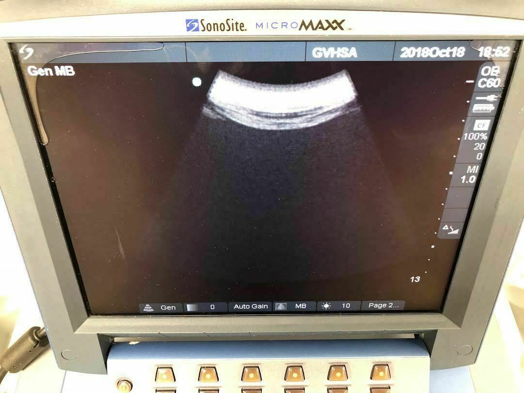 Sonosite C60e Curved Array Convex Array Ultrasound Probe Transducer for MicroMax DIAGNOSTIC ULTRASOUND MACHINES FOR SALE
