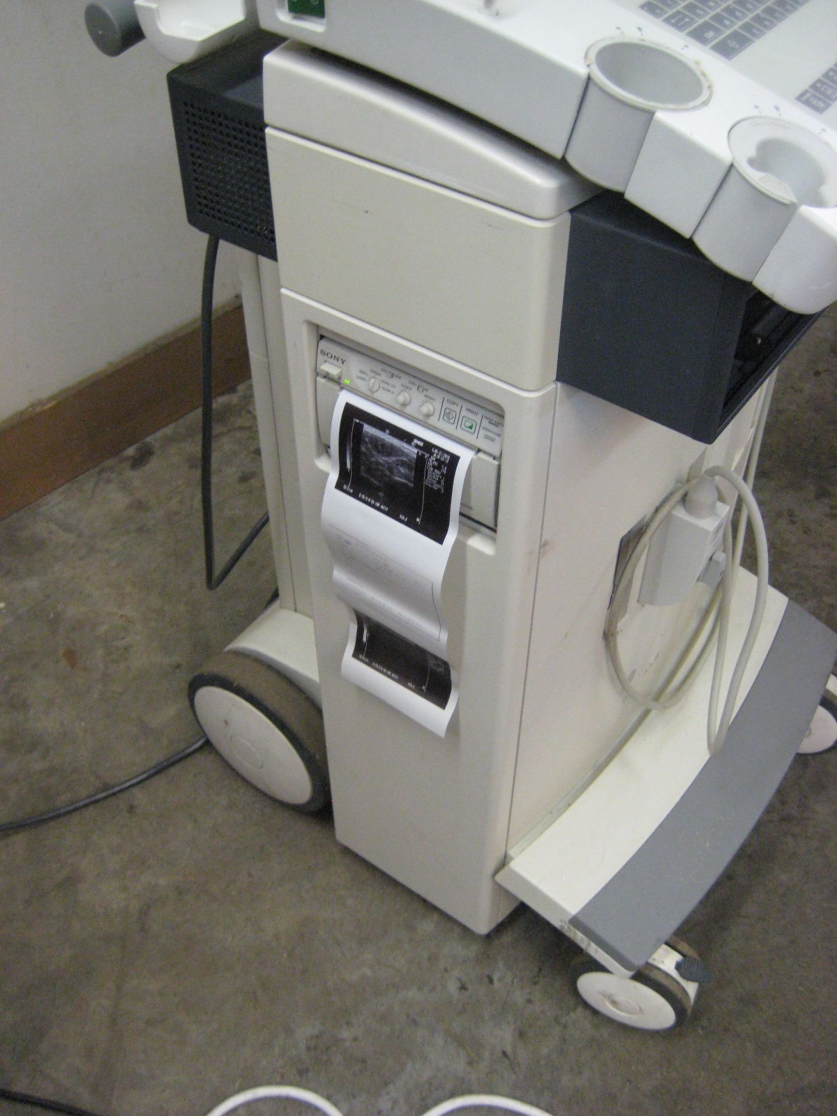 Siemens Sonoline Prima Ultrasound with Linear probe and printer.  Guaranteed DIAGNOSTIC ULTRASOUND MACHINES FOR SALE