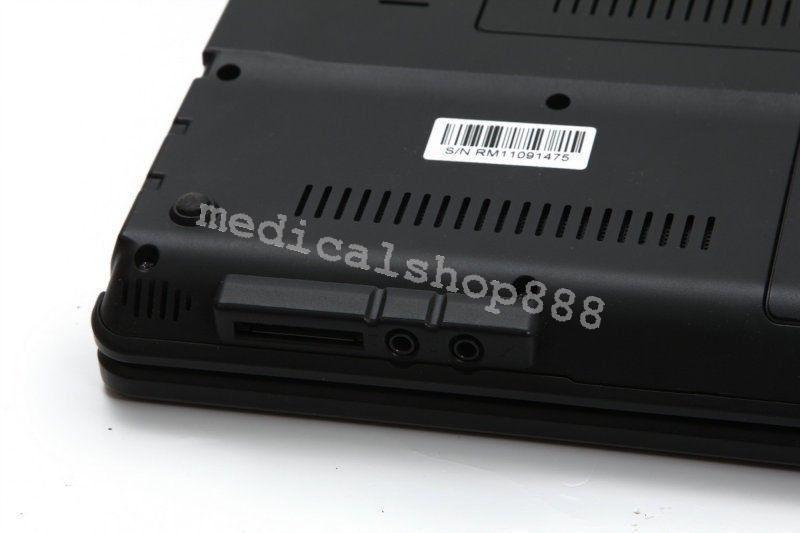 Sale! 10Inch  Laptop Ultrasound Scanner with linear probe 3D Ultrasound Device 190891478627 DIAGNOSTIC ULTRASOUND MACHINES FOR SALE