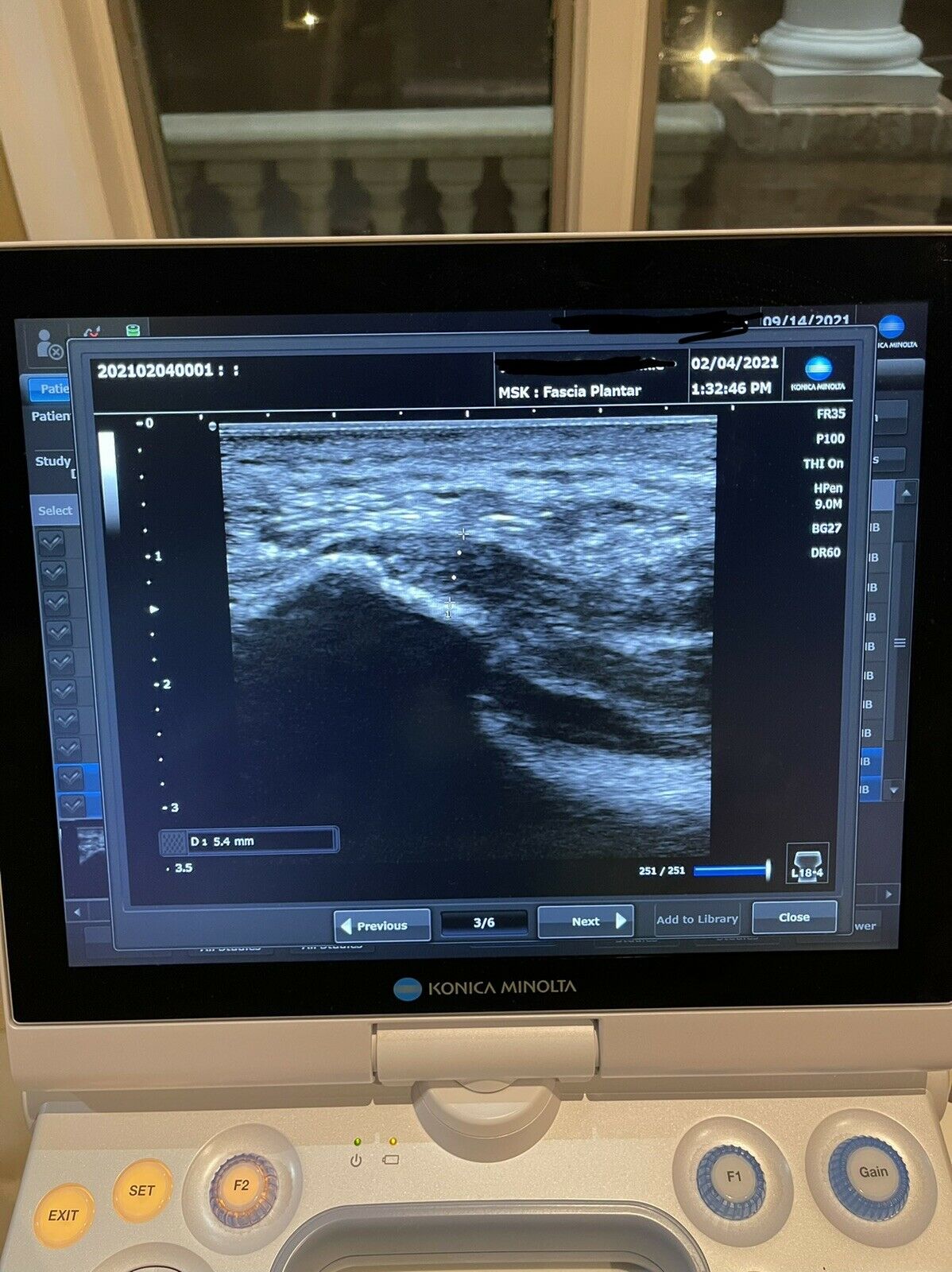 KONICA MINOLTA SONIMAGE HS1 PORTABLE ULTRASOUND MACHINE Full Warranty 2 Probes DIAGNOSTIC ULTRASOUND MACHINES FOR SALE