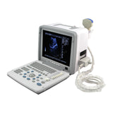 Digital Portable Ultrasound Scanner Machine Convex Linear Transvaginal 3 Probes*