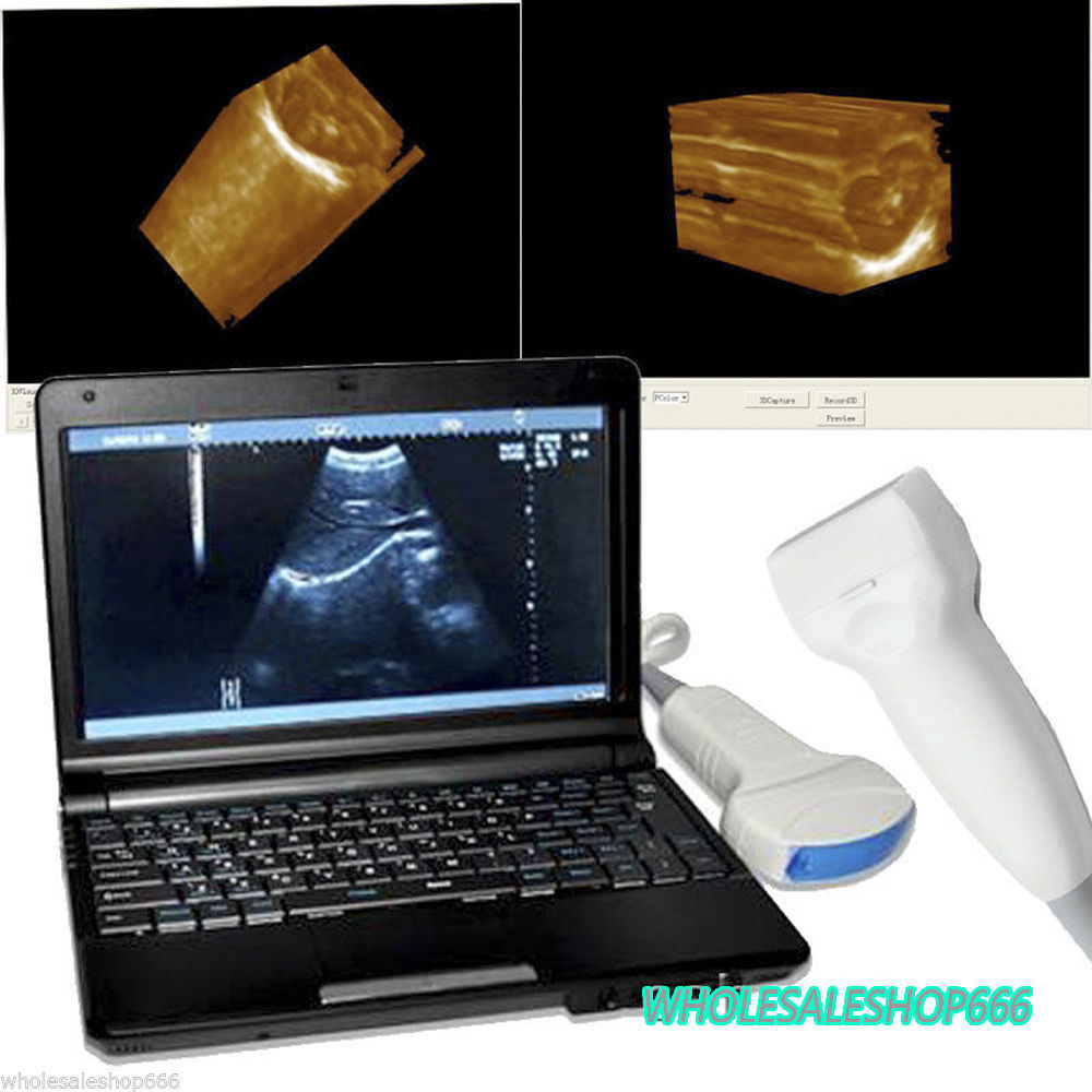 LCD PC Digital Laptop Ultrasound Scanner Machine+Convex Linear Probe+3D Image CE 190891798732 DIAGNOSTIC ULTRASOUND MACHINES FOR SALE