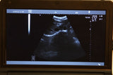 Full Digital Laptop Ultrasound Scanner 2 Probes Covex + Linear Probes 3D Precise 190891802569