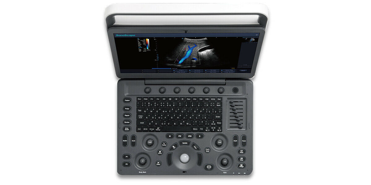 SonoScape E2 ultrasound & One linear array probe L741 Color doppler Vascular DIAGNOSTIC ULTRASOUND MACHINES FOR SALE