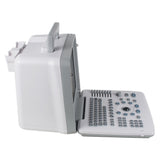 Full Digital Portable Ultrasound Scanner Machine Convex Probe 12inch LCD monitor