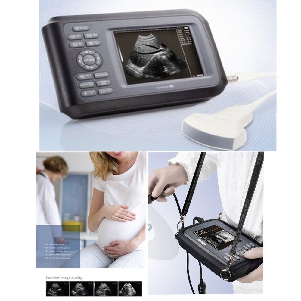 Handheld Ultrasound Scanner Machine Convex Probe+Pulse Oximeter + Battery + Case DIAGNOSTIC ULTRASOUND MACHINES FOR SALE