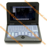 Portable Laptop Machine Digital Ultrasound Scanner, probe, human/vet, USA Fedex