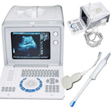 Digital Ultrasound machine Scanner  Convex& linear Probe +3D Software CE Sale 190891211668