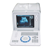 Profession LCD 10‘’Ultrasound Scanner Convex+Linear+Transvaginal Probes 3D Free 190891937803