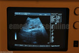 Portable Ultrasound Diagnostic System-ultrasound Scanner+linear Probe+3D Free
