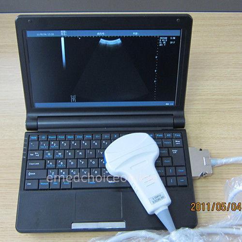 Promotion!!! VET Portable Ultrasound Scanner + VGA + 3D + 5.0 Micro_convex Probe DIAGNOSTIC ULTRASOUND MACHINES FOR SALE