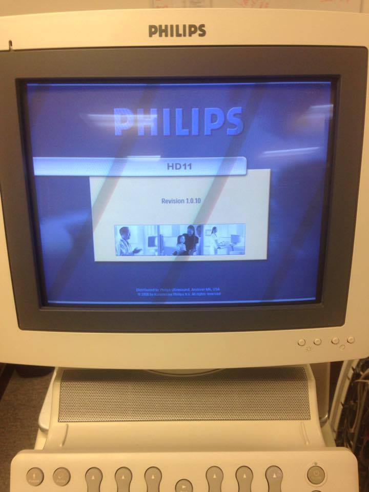 Philips HD-11 Digital Ultrasound Machine