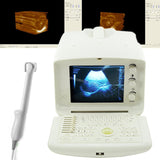 Full Digital Portable Ultrasound Scanner machine +Convex + Vignial  2 Probes+3D