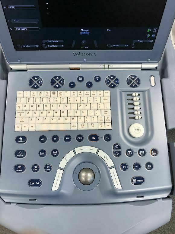 GE Voluson E Portable Ultrasound Machine with Rolling Cart and E8C-RS Probe DIAGNOSTIC ULTRASOUND MACHINES FOR SALE