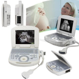 US Notebook Ultrasound Machine Scanner System Convex Probe +3D Software Portable 190891422491