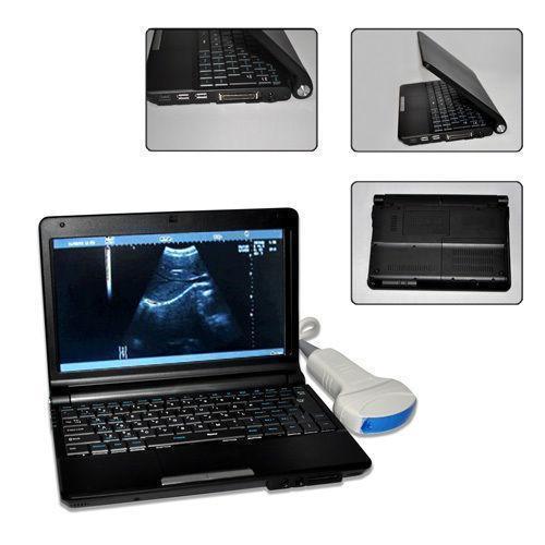 FULL Digital Laptop Ultrasound Scanner+Linear & Transvaginal 2 probe  3D Sale CE DIAGNOSTIC ULTRASOUND MACHINES FOR SALE