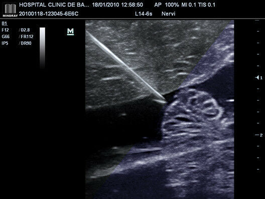 Mindray Advanced M7 CW 2018 Demo Model Ultrasound with 3 Probes, 3 Year Warranty DIAGNOSTIC ULTRASOUND MACHINES FOR SALE