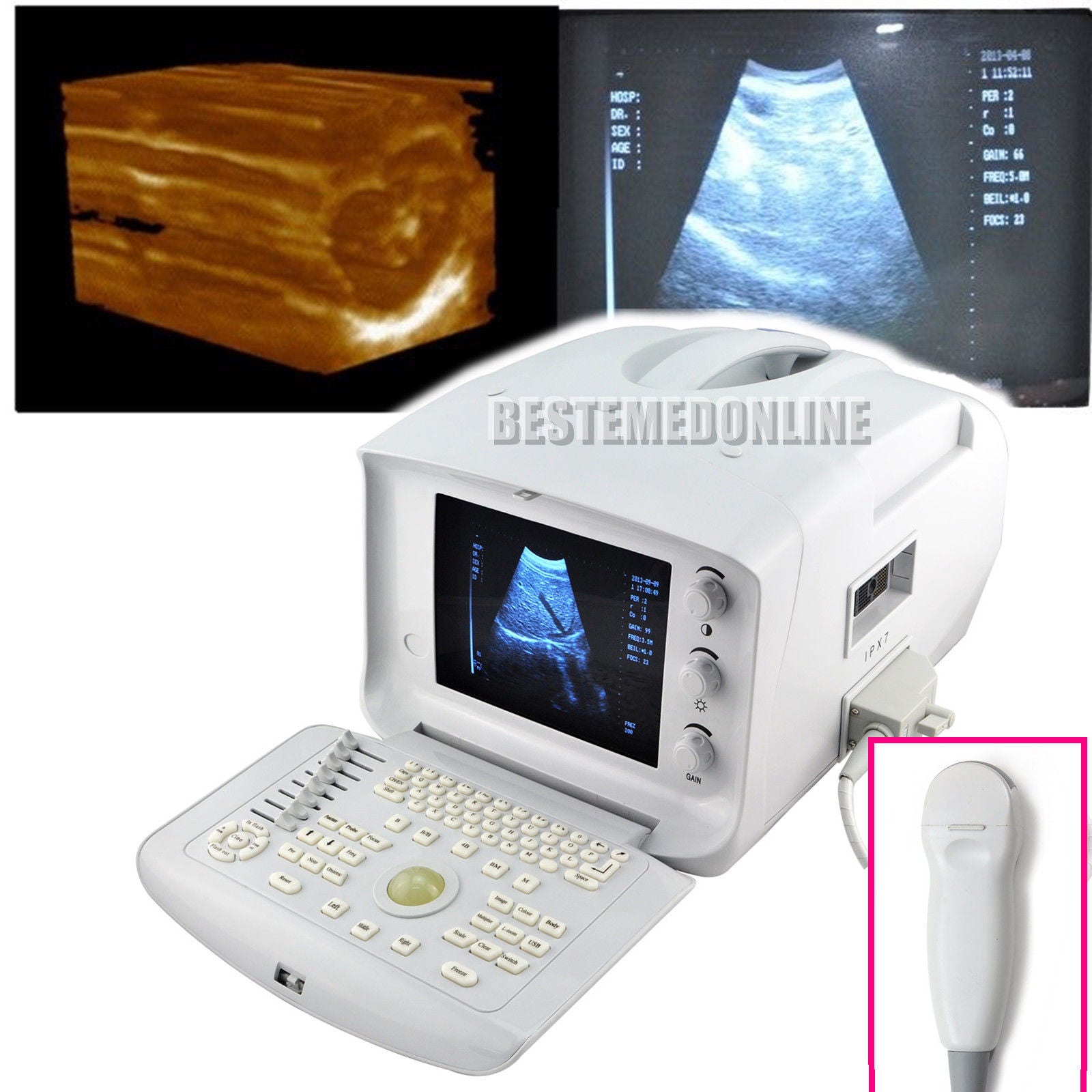 Vet Digital Ultrasound Scanner Machine with Micro-convex Cardiac Probe 3D Image DIAGNOSTIC ULTRASOUND MACHINES FOR SALE