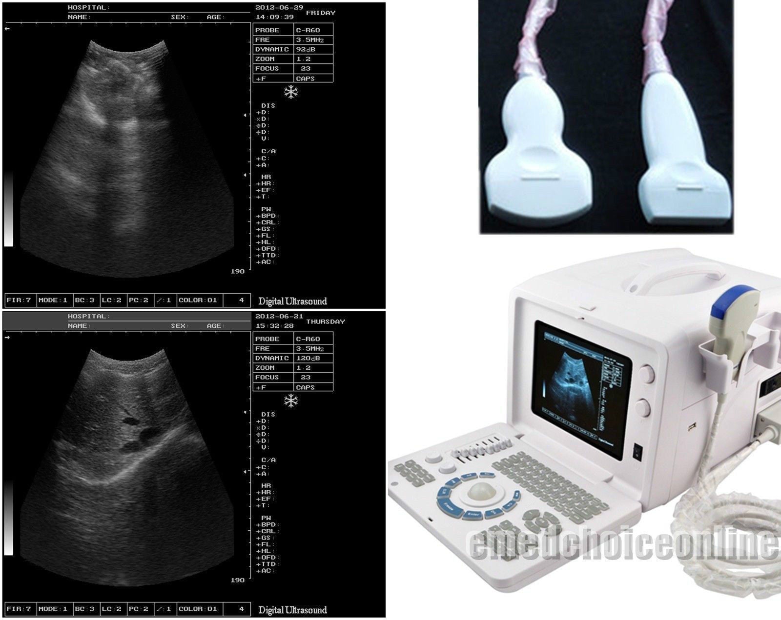 Digital Ultrasound machine Scanner  Convex& linear Probe +3D Software CE Sale 190891211668 DIAGNOSTIC ULTRASOUND MACHINES FOR SALE