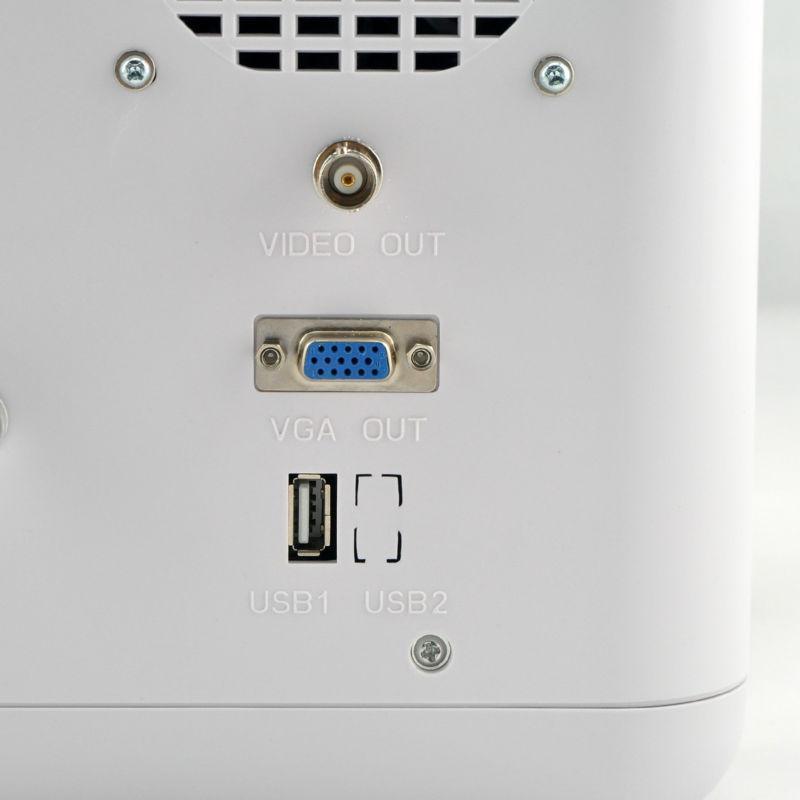 LCD Digital Ultrasound Scanner/Machine Convex Transvaginal Probes +3D Version CE 190891688125 DIAGNOSTIC ULTRASOUND MACHINES FOR SALE