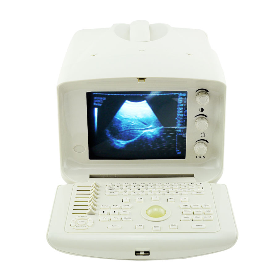 Digital Ultrasound Machine Scanner + Linear probe 3D software Patient monitor 190891647757 DIAGNOSTIC ULTRASOUND MACHINES FOR SALE