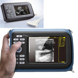 Laptop Machine Scan Digital Ultrasound Scanner Convex Linear Transvaginal Probe